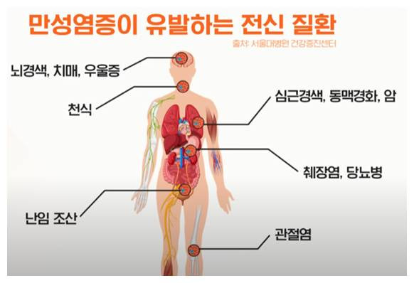 만성염증을 유발하는 질환 설명 그래픽